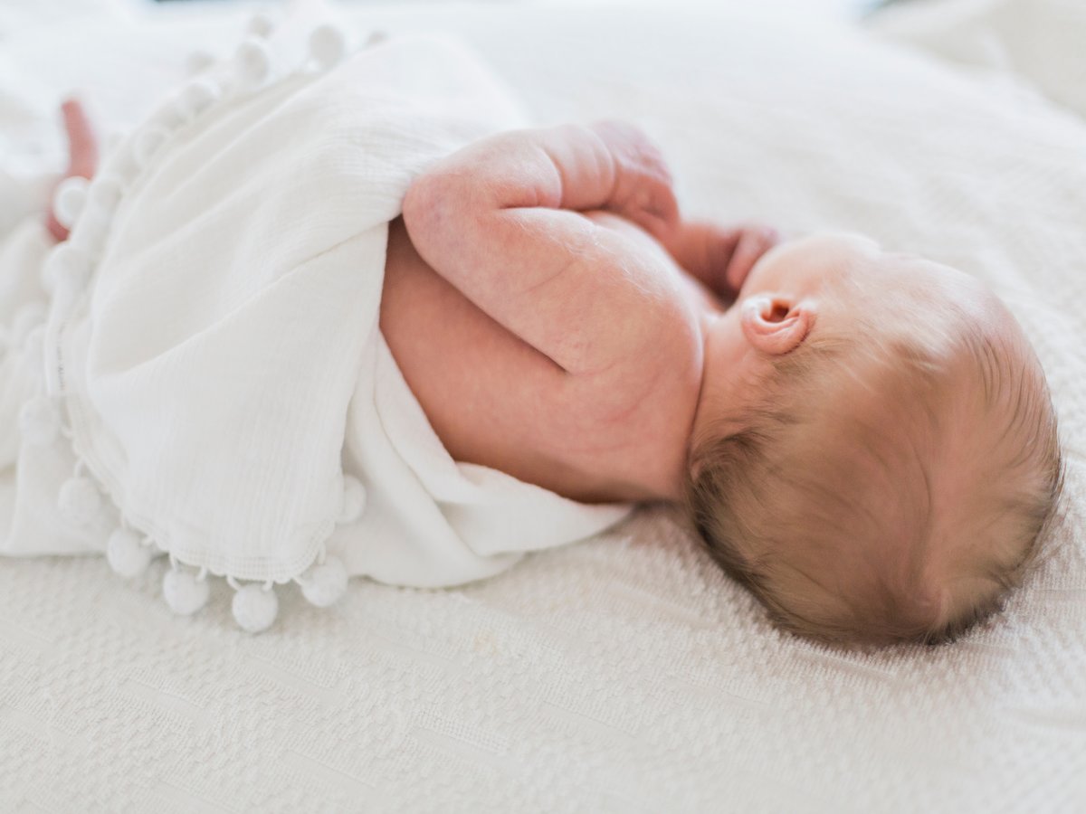 Causes of Diaper Rash in Babies